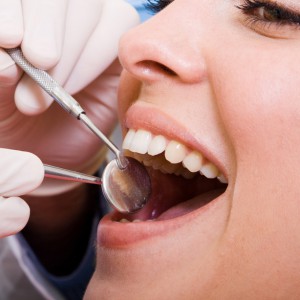 Dental Checkup