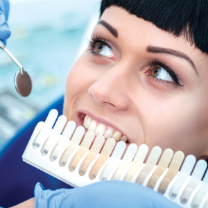 What-Color-are-your-Teeth